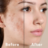 before-after-comparison.jpg
