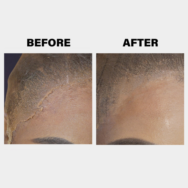 c_wb_lace-melting-spray_before-after-min_1_987b3f71-8c28-4e27-9818-d1a432b987e7.jpg c_wb_lace-melting-spray_before-after-min_1_987b3f71-8c28-4e27-9818-d1a432b987e7.jpg