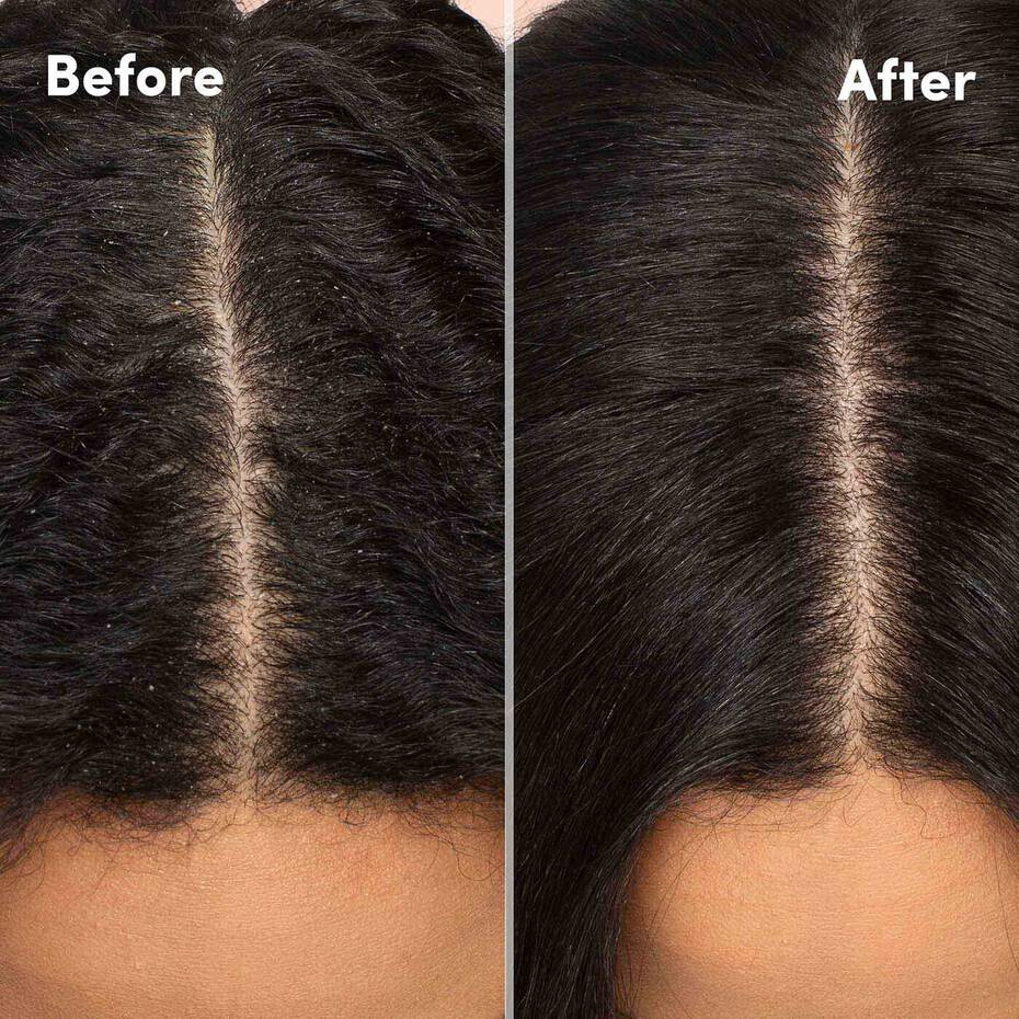 mizani-scalp-care-hydrating-shampoo-169oz-7887326