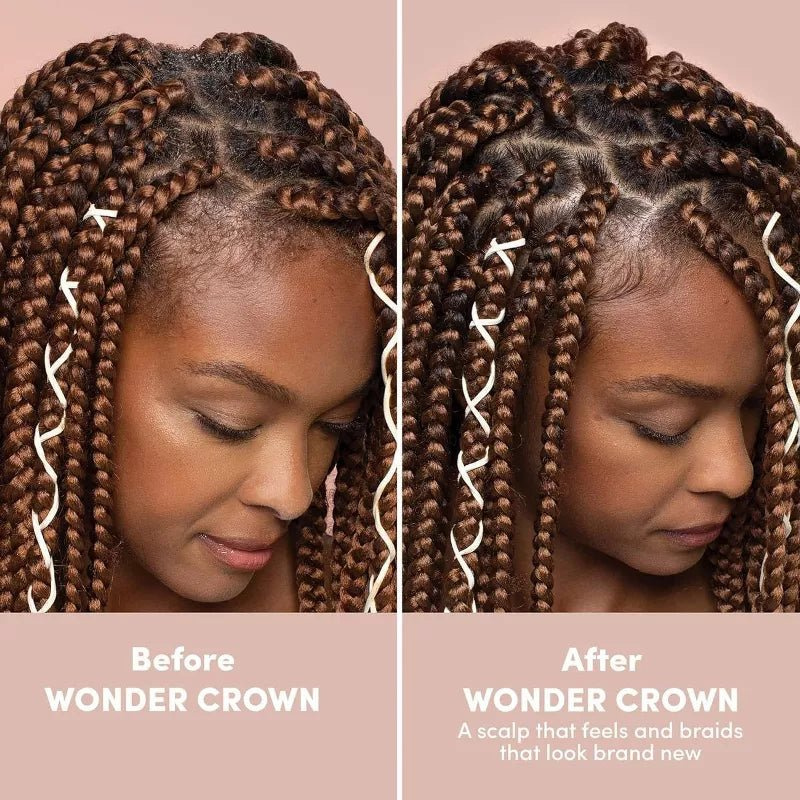 mizani-wonder-crown-scalp-cleanser-dry-scalp-dandruff-treatment-stimulates-hair-growth-68oz-306193