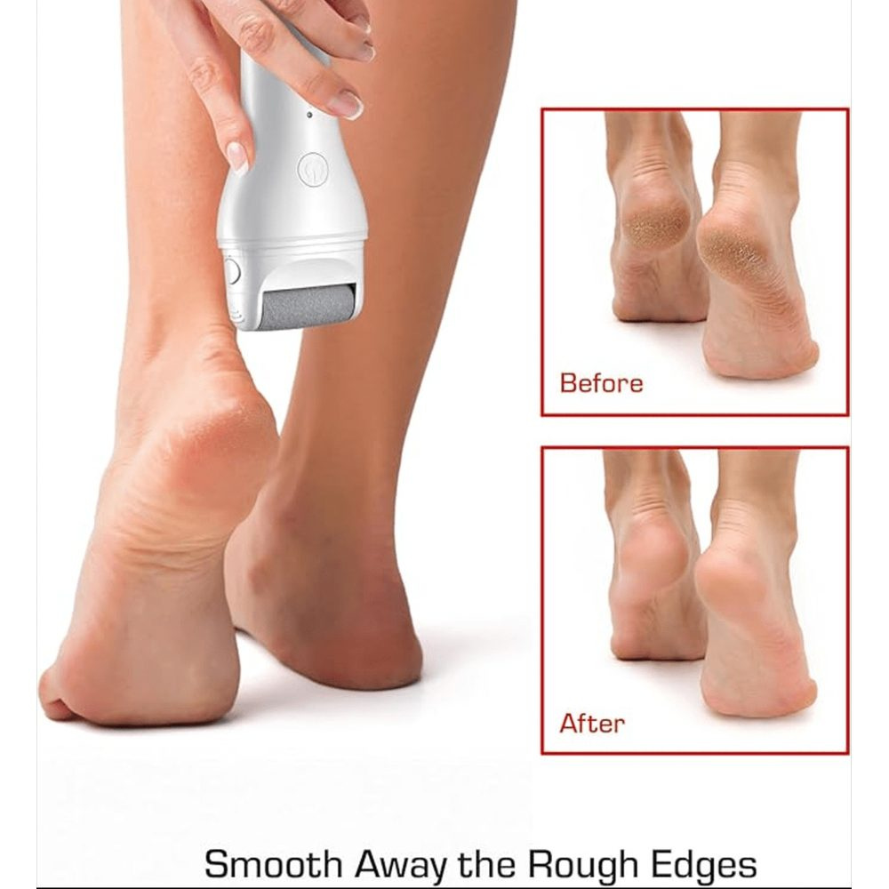 red-by-kiss-cordless-foot-callus-remover-dual-speed-pedicure-tool-w-3-rollers-curved-head-wet-dry-use-2-hour-runtime-432765